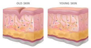Old vs Young Skin
